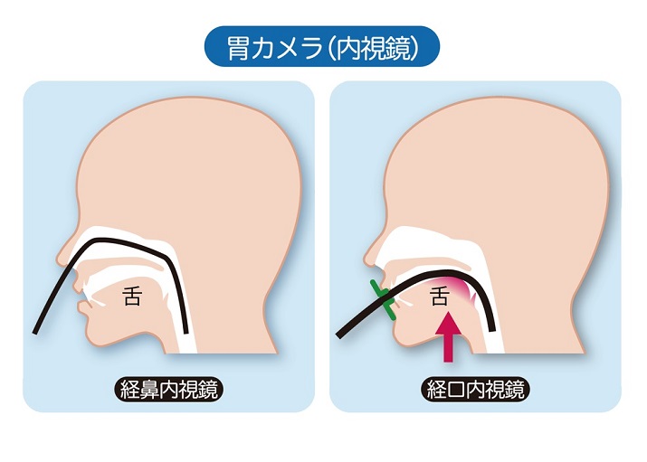 経口・経鼻内視鏡検査